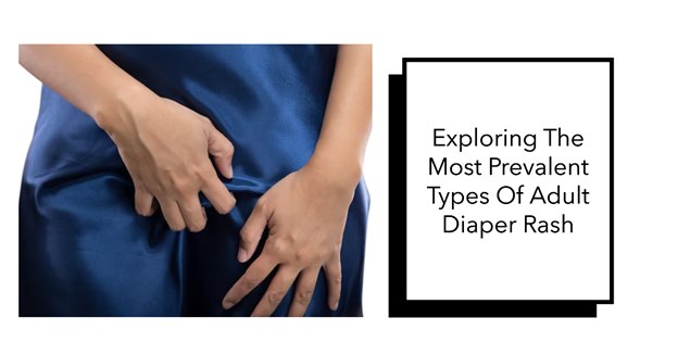 Types of Adult Diaper Rash