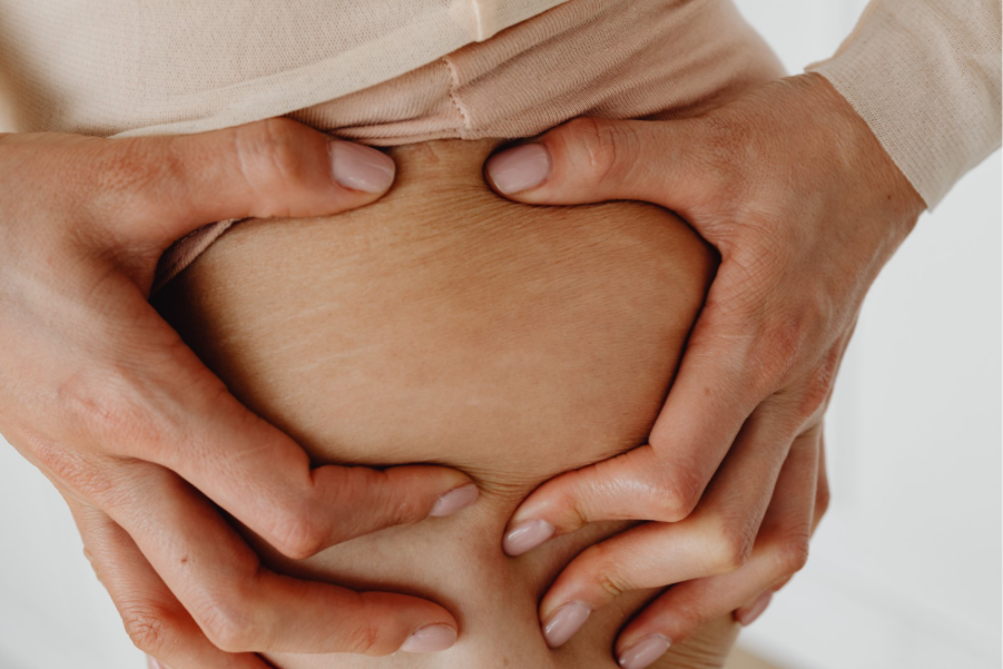 Adult diaper rash management strategies