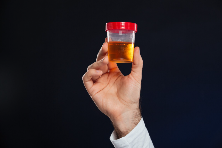Understanding Oily Urine: Causes and when to see a doctor